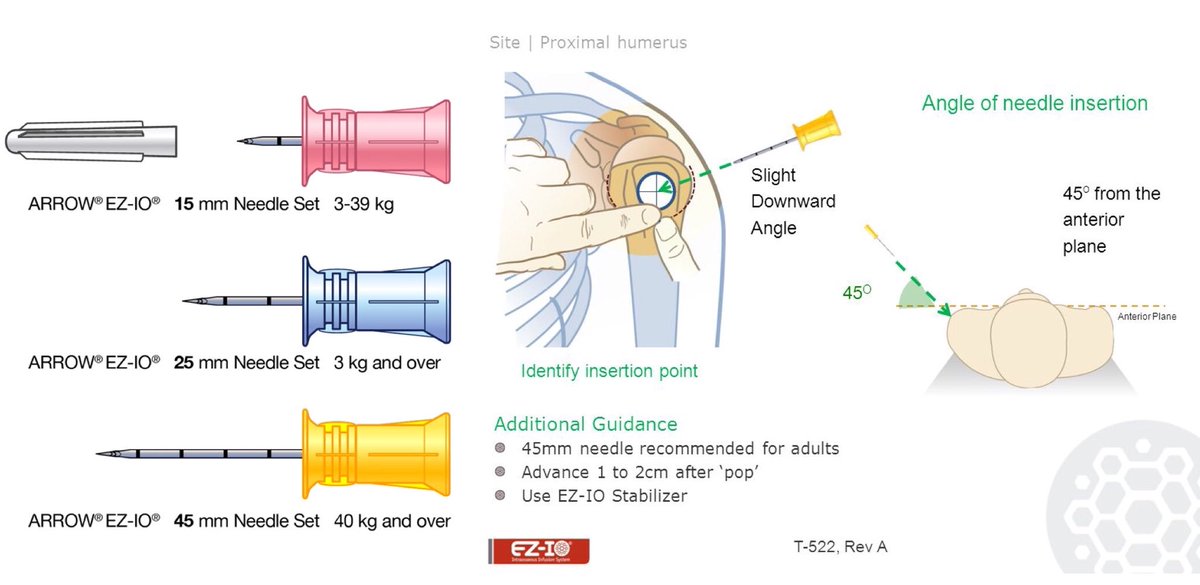 A_m_b_01's tweet image. #EZIO in humeral head of an adult

Rule of 45s:
- 45mm needle
- 45° angle between shoulder &amp;amp; head
- 45° to anterior plane

Benefits vs tibia:
- Meds from syringe➡️R atrium in 3 sec
- Flow of 5L/hour (vs 1L/hour)
- Can be used with pelvic/abdo trauma
- Less pain in conscious pt