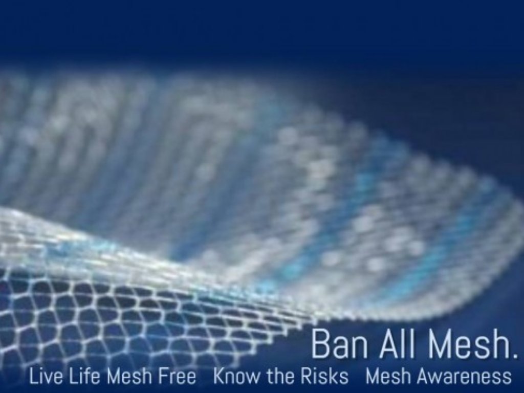 Hide nothing, for time, which sees all and hears all EXPOSES All #Mesh #Mad #Science meets #Quackery #SurgicalMesh is #Incompatible with #Human #Tissues #immunotoxicity #TestTheMesh #polypropylene #Plastic #Preventable #Harm #Time to #CleanThisMeshUp #BanAllMesh #TuesdayThoughts
