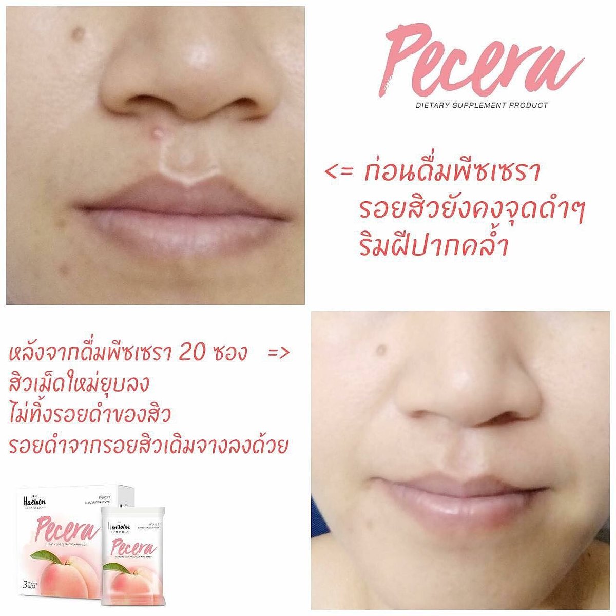 Pecera_by_haewon (@ByPecera) / Posts / X