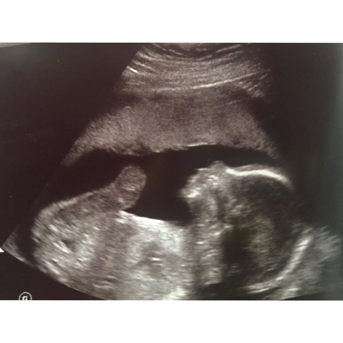 Drose__'s tweet photo. I love you so much, my heart is so full๐๐น #scarlettrose #theroguebaby #gymbaby #cheerbaby #rosebud https://t.co/gmxZHYr4nO