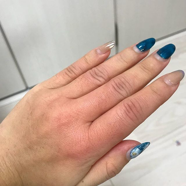 土橋こずえ やっちまったー 昨日お湯を被ってしまい火傷した 寝てる間中 保冷剤変えながらひやしてたのに 朝になっても痛み止まらず腫れている もともと太い指がさらに 笑 取り敢えず不便 火傷 1度熱傷 ヒリヒリする 赤い 腫れ 土橋こずえ やっちまったー 昨日お湯を被ってしまい火傷した 寝てる間中 保冷剤変えながらひやしてたのに 朝になっても痛み止まらず腫れている もともと太い指がさらに 笑 取り敢えず不便 火傷 1度熱傷 ヒリヒリする 赤い 腫れ