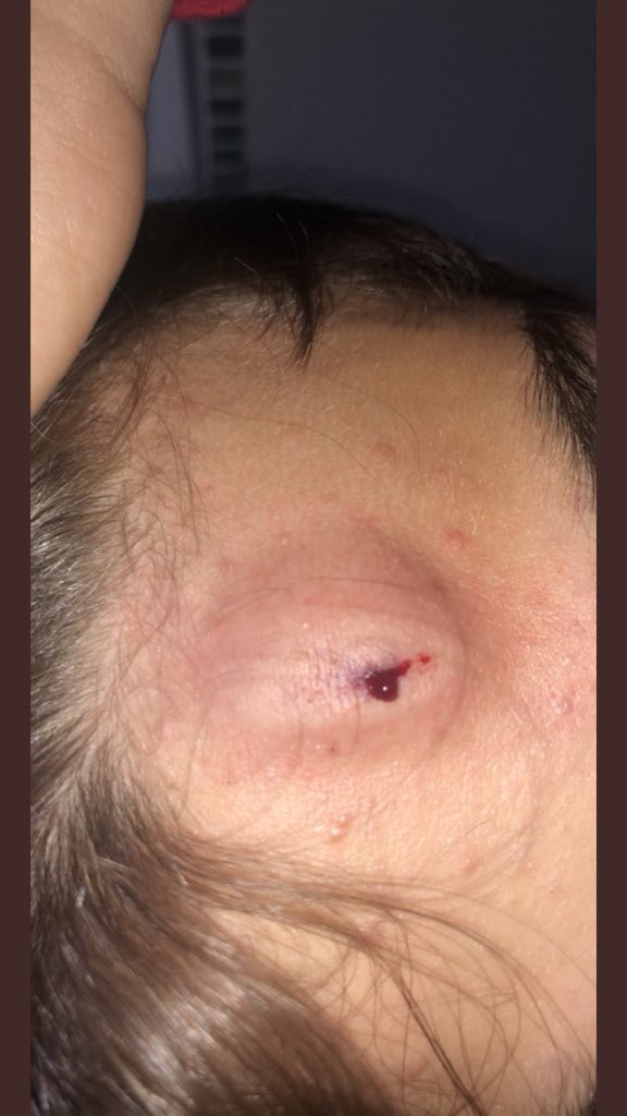 pilirinaldi's tweet photo. Rt o te sale esto en la cabeza!!! https://t.co/R0GQsR5PeH
