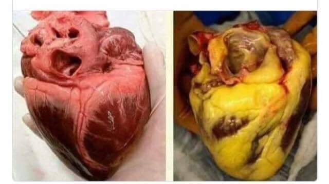 valmmd's tweet photo. Corazón sano / Corazón de chica obesa que se acepta tal y como es, sin estándares de belleza y con colesterol https://t.co/E6zcwFDrva