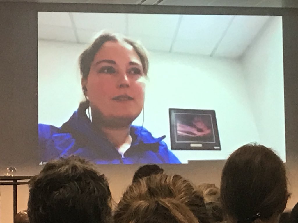 annecreaton's tweet photo. #RATH extraordinary former triathlete cardiac arrest survivor speaks about being the first patient to walk on ecmo at The Alfred prior to her heart transplant. https://t.co/LeGWLwRYt3