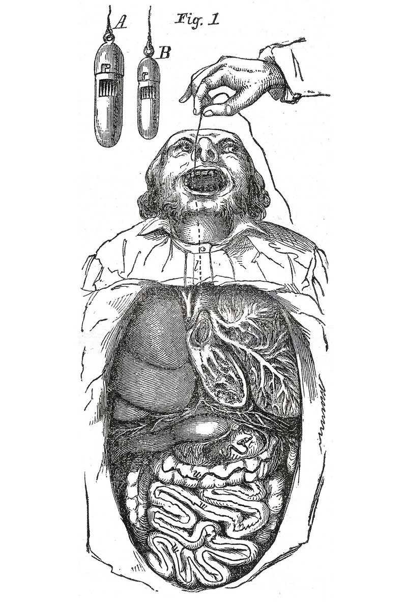 Cabinet Magazine On Twitter Tapeworm Cures Once Included Angling With A Baited Silk Thread As Well As Waiting Open Mouthed Beside A Tantalizing Bowl Of Milk Natalie De Souza On The Prehistory Of