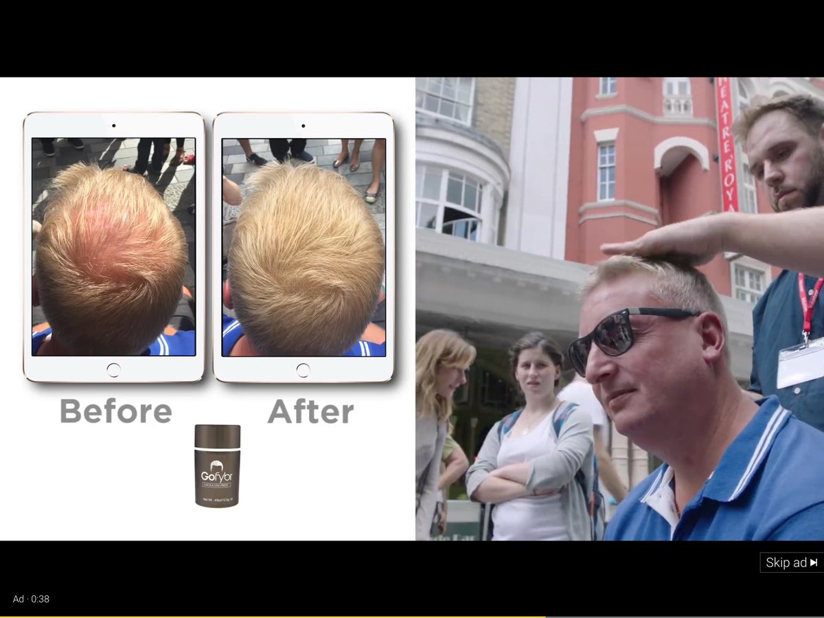 badgersbottom's tweet image. How to cover a bold patch temporary