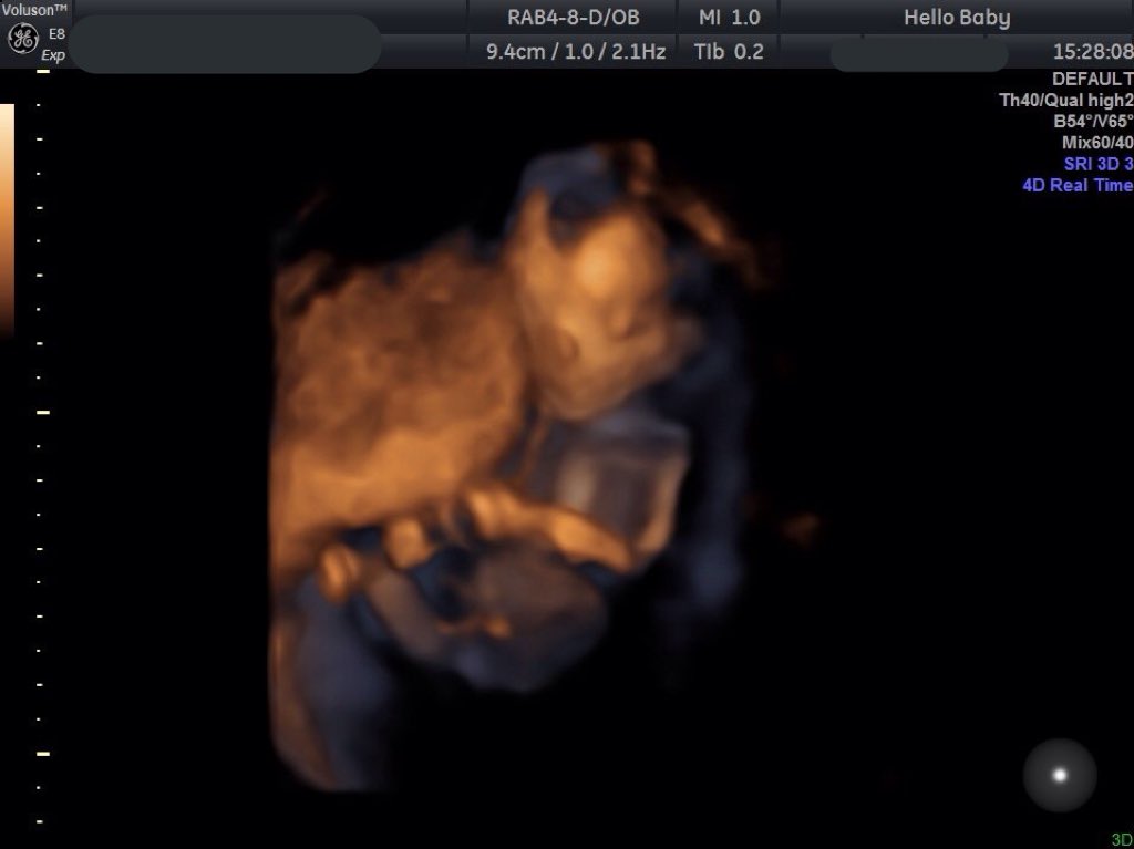 ChloeeO2L's tweet photo. Can't wait to meet you next month😍 love you already 💙 https://t.co/cJrENrpHNn