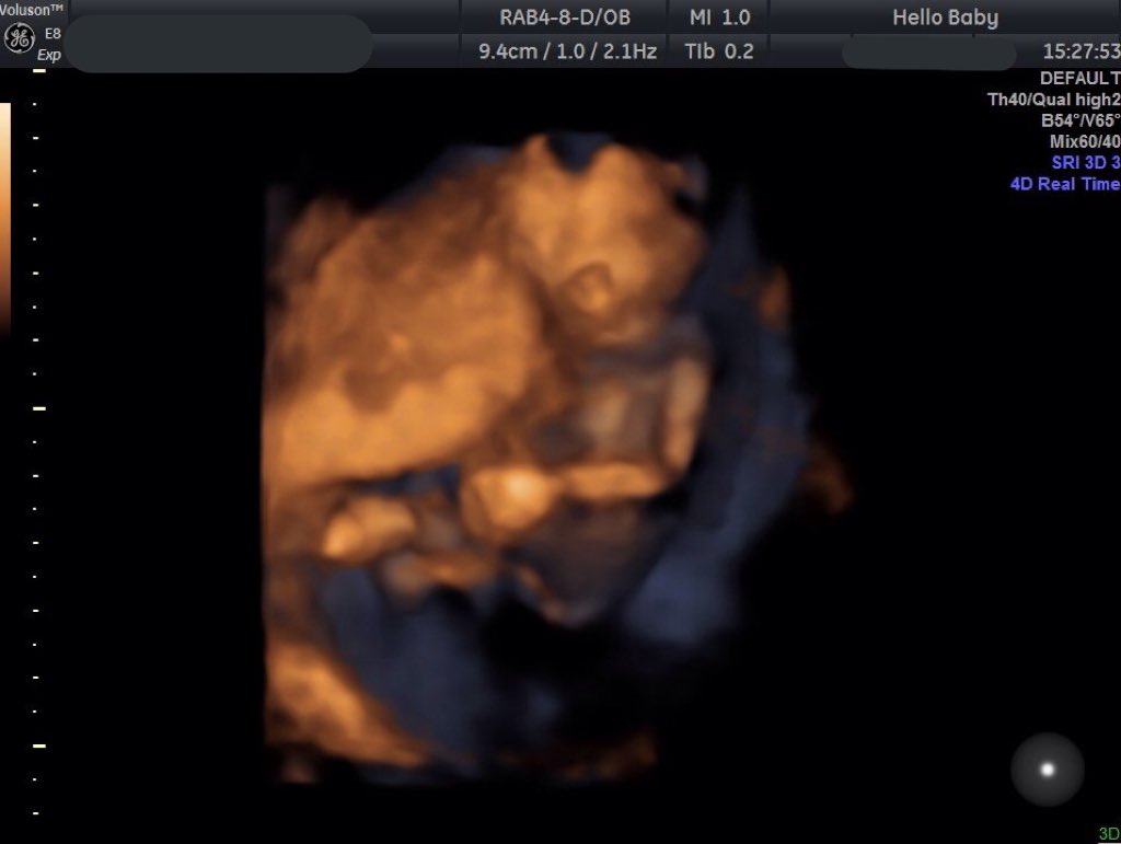 ChloeeO2L's tweet photo. Can't wait to meet you next month😍 love you already 💙 https://t.co/cJrENrpHNn