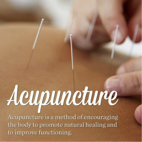 CunicoHealth's tweet photo. You may use acupuncture to treat your neck and shoulder pain, and find the added benefits of reduced stress levels, enhanced sleep quality, better digestion, and improvements to your overall mood. Give acupuncture a try this Fall! #AcupunctureHeals #WisdomForWednesday https://t.co/zk2jbrdH7b
