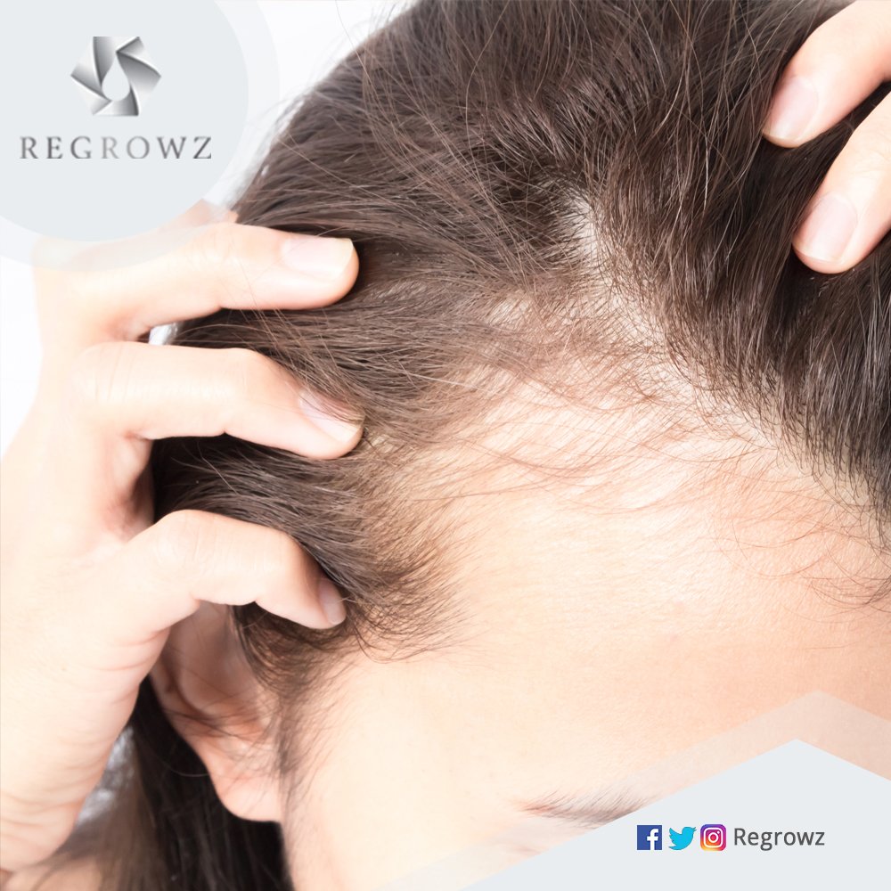 Regrowz Haircare on Twitter: Regrowz Haircare on Twitter: