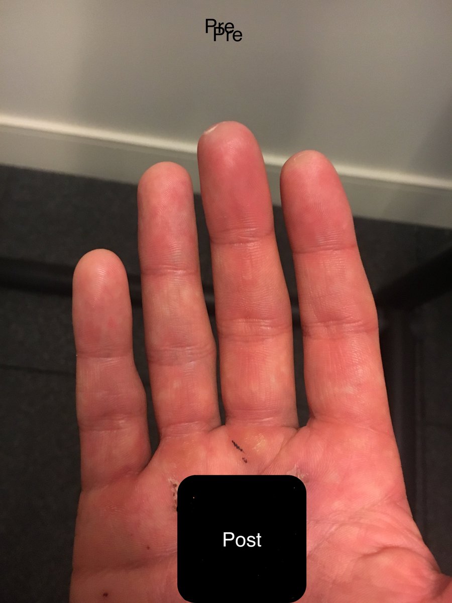 Matt Bowman tweet media