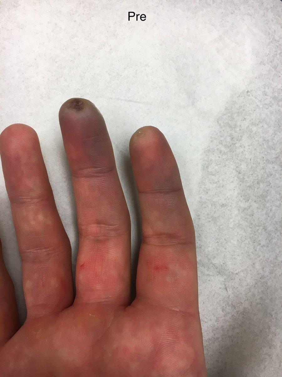 Matt Bowman tweet media