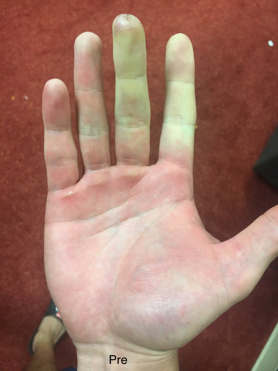 Matt Bowman tweet media