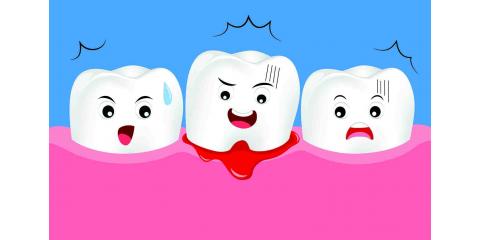 dfd_dental's tweet photo. Don't let your gums get angry, call today and schedule a cleaning before insurance runs out for the year! 
#DFD #DecaturFamilyDentistry #Gumdisease #Hygiene #Healthygums #weloveourRDH https://t.co/YYJHq7PVzm