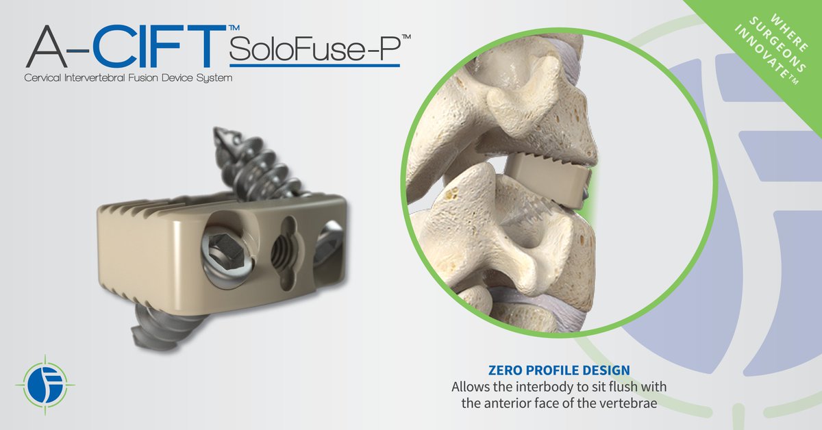 SpineFrontier's tweet photo. We're at the one week countdown to #NASS2018 and we hope to see you there - to check out A-CIFT #LessExposureSurgery technology, with its sleek zero profile design. #NASS #NASS18 #orthopedics #spine #fusion #cervical #lumbar #kicventures #LES #MIS #minimallyinvasive https://t.co/jLIlSpGRMM