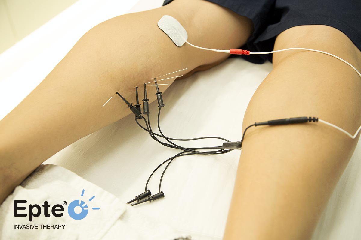 EPTE IONCLINICS tweet media