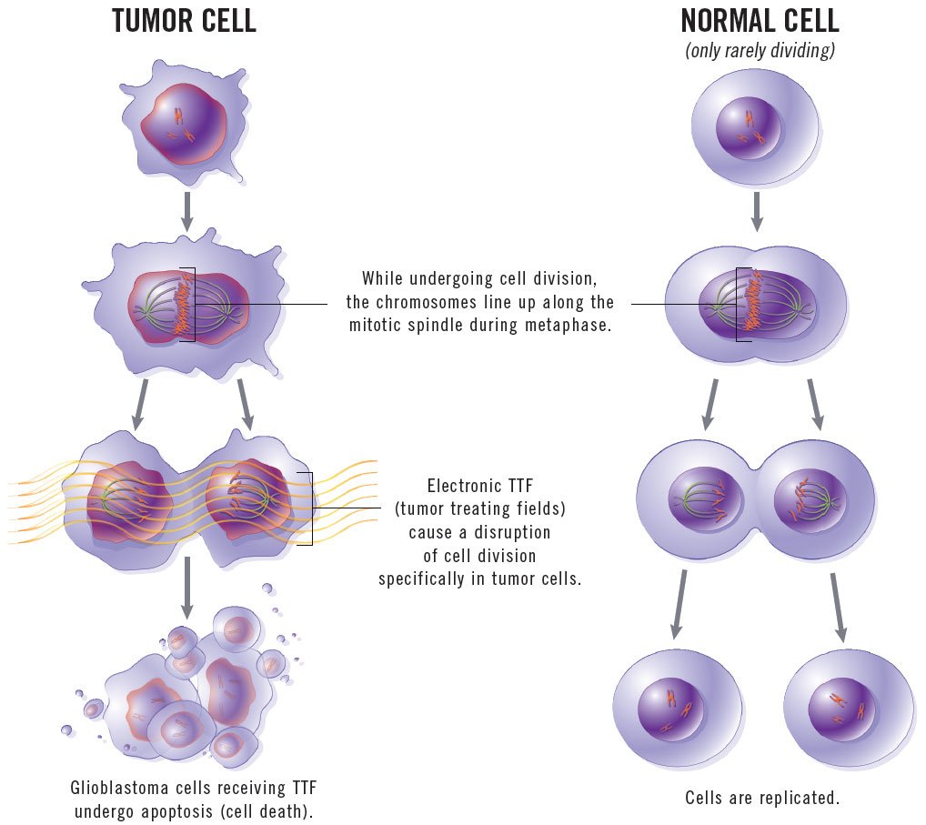 can you have emphysema without symptoms