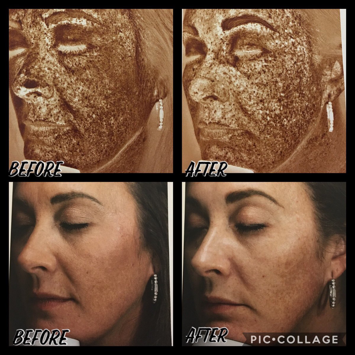 zo skin health results