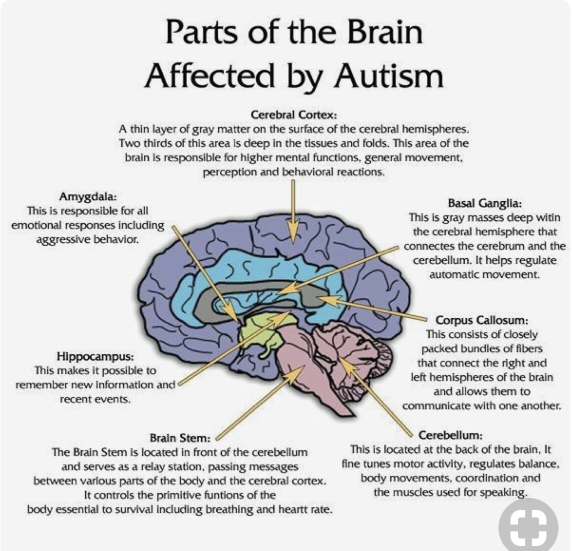LittleGems_RSA's tweet photo. Parts of the brain affected by #Autism, great for therapy feedback. #specialneeds https://t.co/VipeRvpEXb
