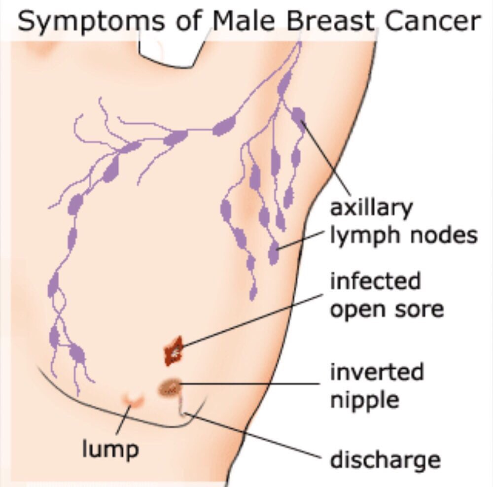 The Real Reason Your Breasts Are Sore Before Your Period