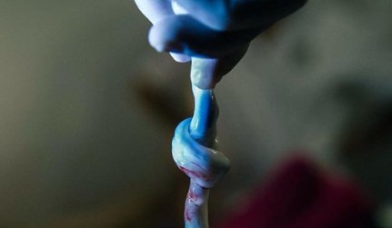 True knot of #umbilicalcord! 💙
Keep an eye on my feed where I explain the ins and outs of this!

Image by instagram.com/rayke_geboorte…