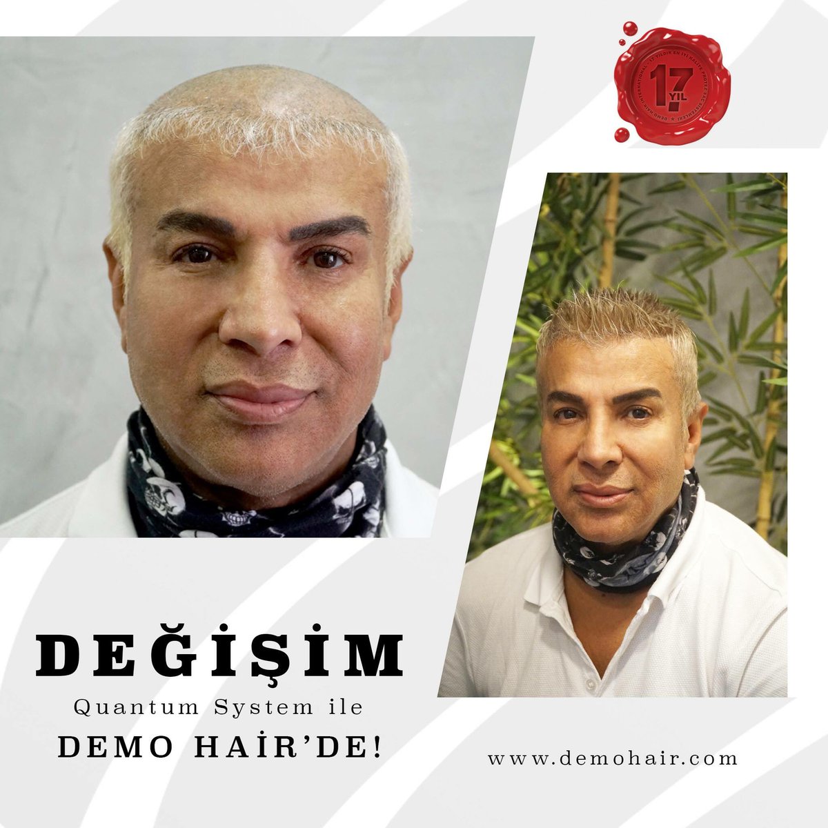 demohair's tweet image. Hayalinizdeki Saç #QuantumSystem Kalitesiyle #DemoHair’de!
Sizi de İnanılmaz Değişimleri hemen yaşamaya başlamak için Demo Hair’e bekliyoruz!
