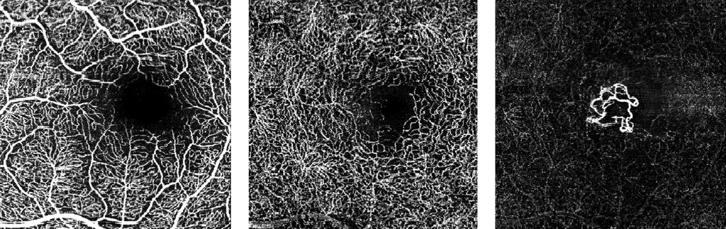 OpSupAssc's tweet photo. Heidelberg Engineering has been cleared by the @US_FDA to make its OCT Angiography Module (OCTA) available for new and existing Spectralis upgradeable diagnostic imaging devices. #optometry https://t.co/aGu1DpyWC1 via @OptometryTimes
#FMOMember
#Optrafair https://t.co/sQl2nOGVfY