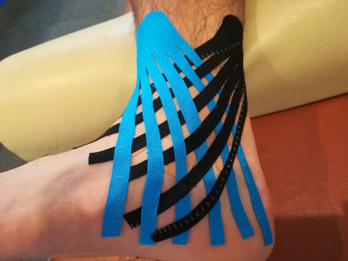 ポップくん 医大前整骨院 على تويتر 捻挫などにオススメなkt テープの貼り方 八幡西区 北九州 整骨院 アスリート治療 エレサス ハイチャージ