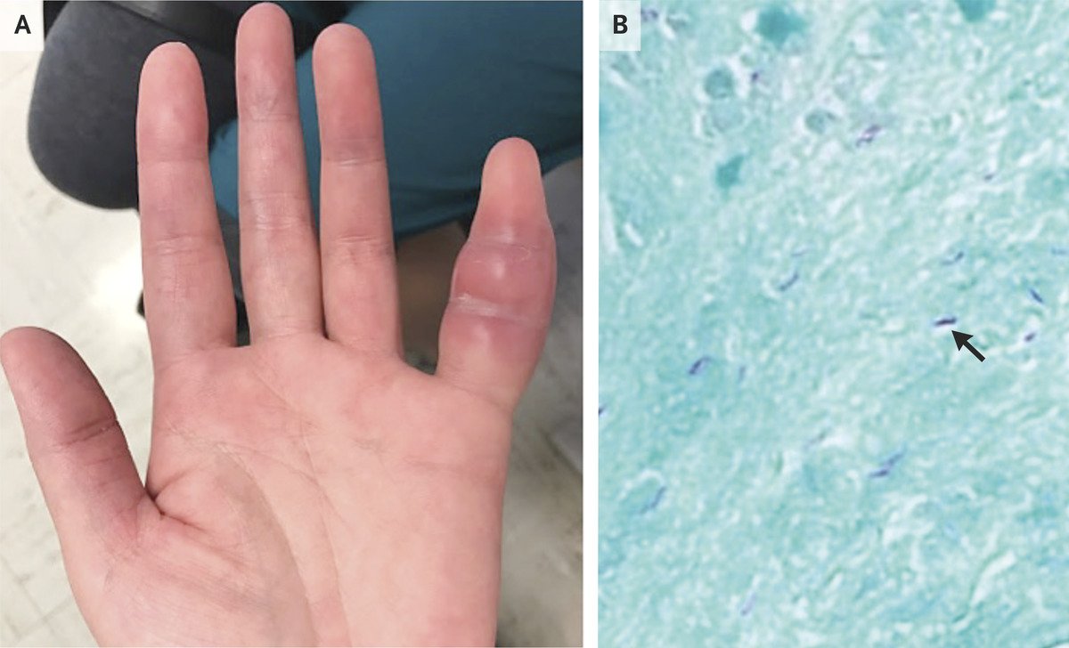 NEJM tweet picture