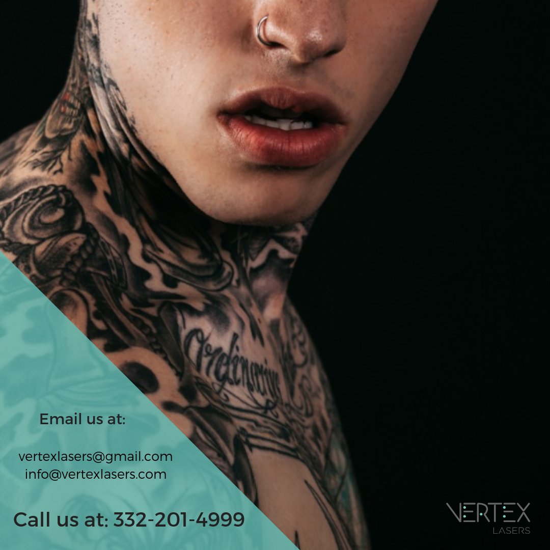 vertexlasers's tweet photo. From 2016-2017 11% of Americans who have tattoos have either removed it or are planning to have them removed. 
#vertexlasers #lasertattooremoval #tattooremoval #tattooremovalmachine #qswitch #qswitchlaser https://t.co/LOYlgkVx6n