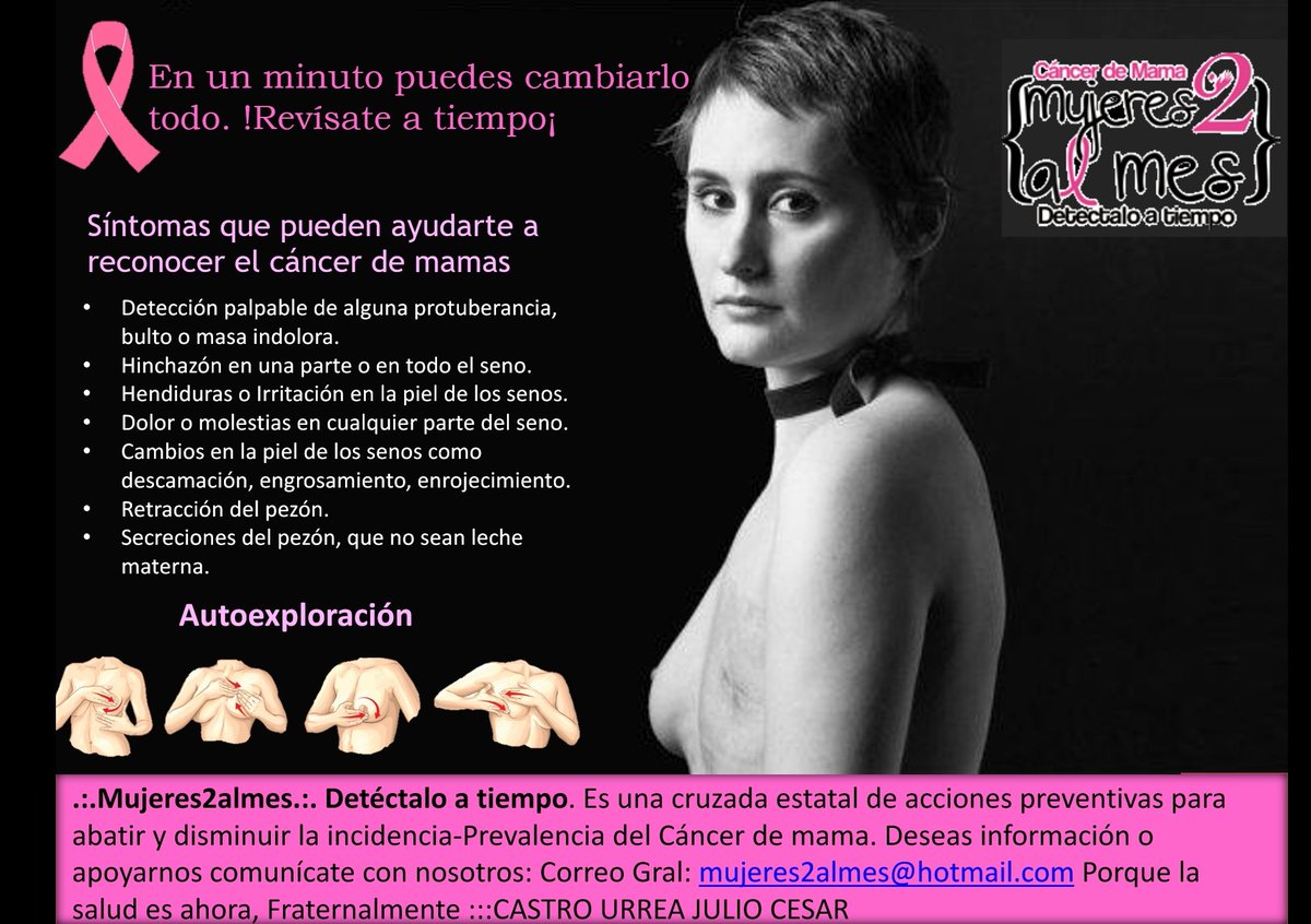 JulioCe24960907's tweet photo. Los síntomas del cáncer de mama pueden incluir un bulto en la mama, un cambio de tamaño de la mama, y secreciones del pezón. El autoexamen y la mamografía puede ayudar a diagnosticar el cáncer de mama en forma temprana, cuando es más tratable. #medicosconcausa #Mujeres2almes https://t.co/MKhps6XlJ3