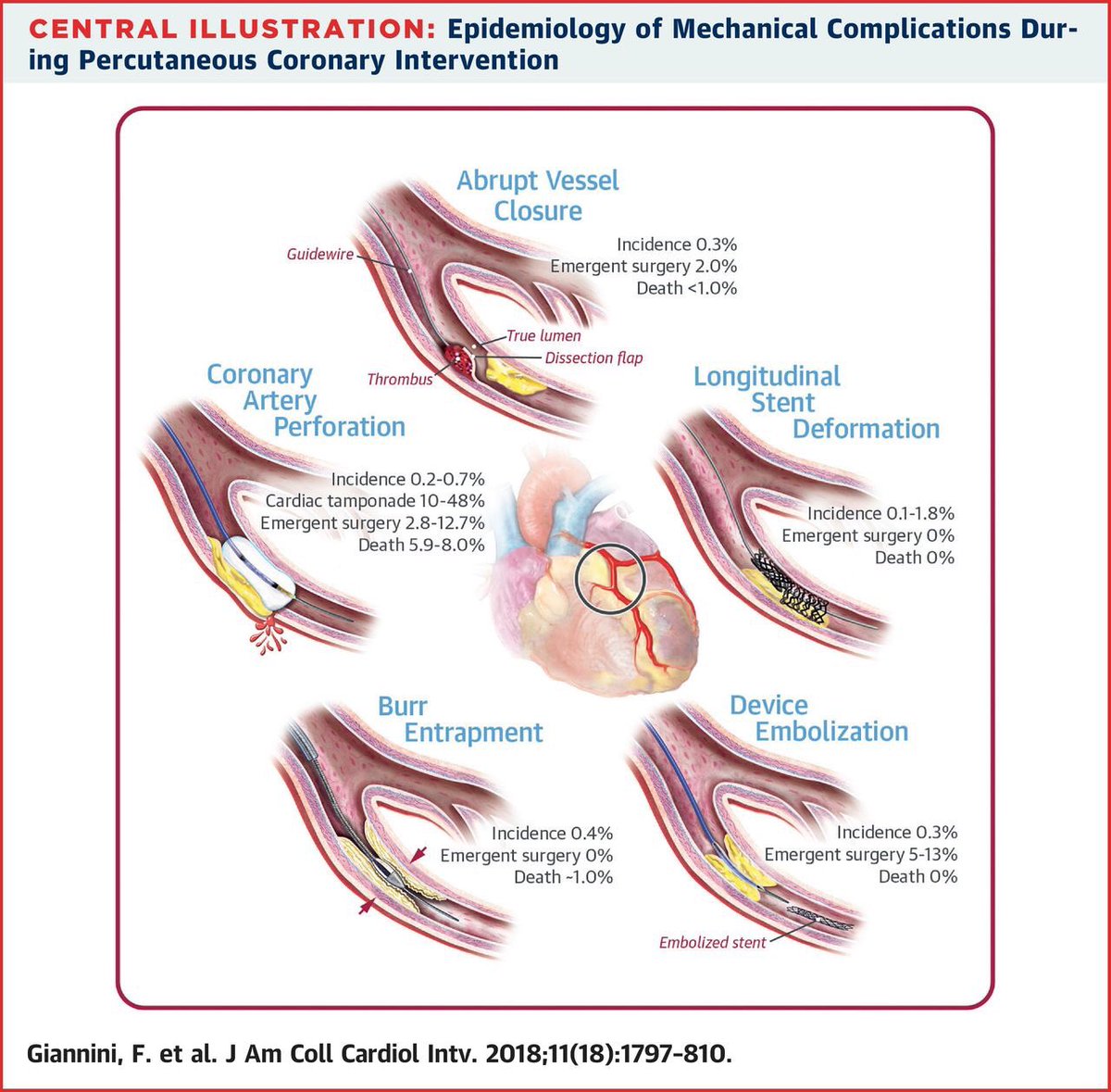 AntonioJordanR's tweet photo. 👌🏻Epidemiologia y complicaciones de la PCI via @JACCJournals #JACCINT https://t.co/DyxhmnSdD4 https://t.co/iOEjDZsTKg