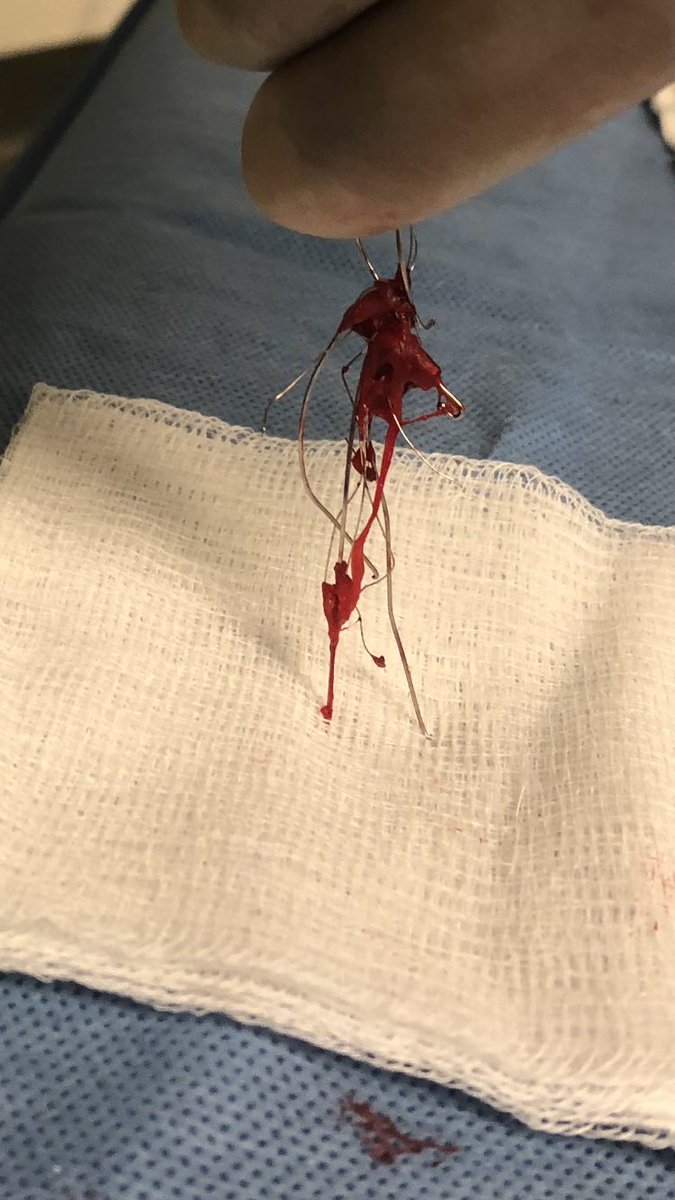 JonnyMoriarty's tweet photo. 56 years of filtration all ended in one short week.... #IRad https://t.co/QwIu7INZMa