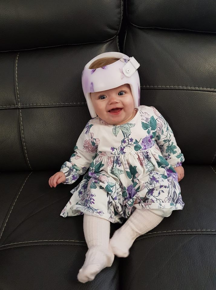 technoinmotion's tweet photo. Isla has taken to her new TiMband like a duck to water! Well done Isla and good luck with your journey π
#TiMband #BabyHealth #FlatHeadSyndrome https://t.co/Rb4P7RPCfp