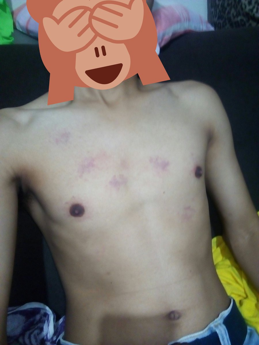 MattyGas14's tweet photo. First to experience BDSM.
Itinali pa niya talaga ang kamay ko para lang di ako makapanlaban. Ending. Ayan pito. Kahit bilangin niyo pa. #satisfied #firstBDSM #092118 https://t.co/Wy6GxvVjL3