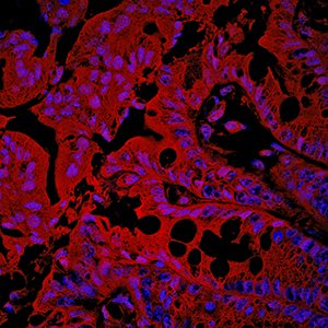 Cincinnati Children's (@cincychildrens) on Twitter photo Experts in the <a href="/AlenghatLab/">Theresa Alenghat</a> describe how our gut microbes can influence the risk of #Crohns disease. goo.gl/gLHLkv. Read the study <a href="/JCI_insight/">JCI insight</a> goo.gl/UG2Whp Experts in the <a href="/AlenghatLab/">Theresa Alenghat</a> describe how our gut microbes can influence the risk of #Crohns disease. goo.gl/gLHLkv. Read the study <a href="/JCI_insight/">JCI insight</a> goo.gl/UG2Whp