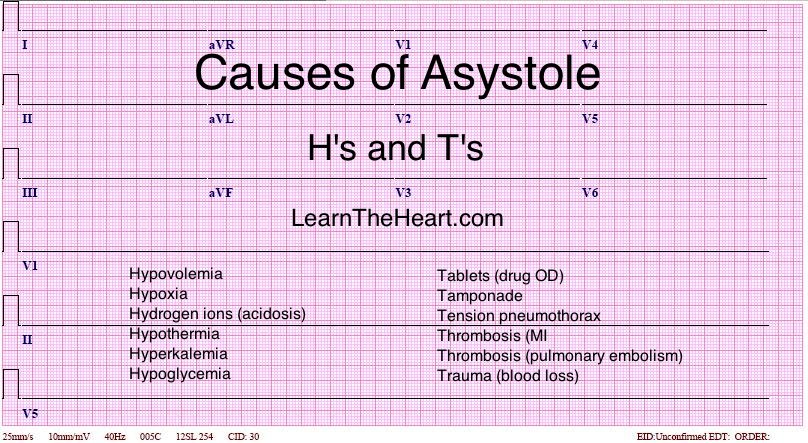 Learntheheart Comさんのツイート Asystole Causes H S And T S Usmle Ecg Cardiology Asystole Acls