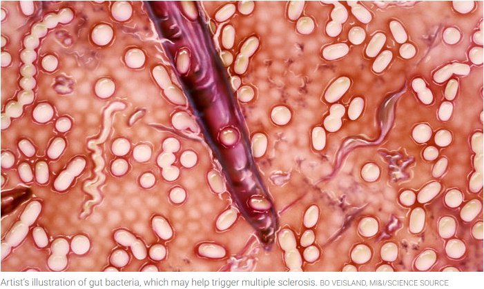 Multiple sclerosis affects 2.5 million people worldwide, damaging their nerves &amp; leading to muscle weakness, blindness, &amp; even death. Two studies linking the disorder to the gut microbiome could one day lead to improved treatments. #ScienceMagArchives bit.ly/2pqKqRc