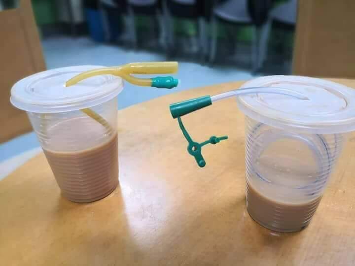 ilvzvhg's tweet photo. Kaedah alternatif replace straw plastik... #rylestube #foleycatheter https://t.co/DYuDleBDxN