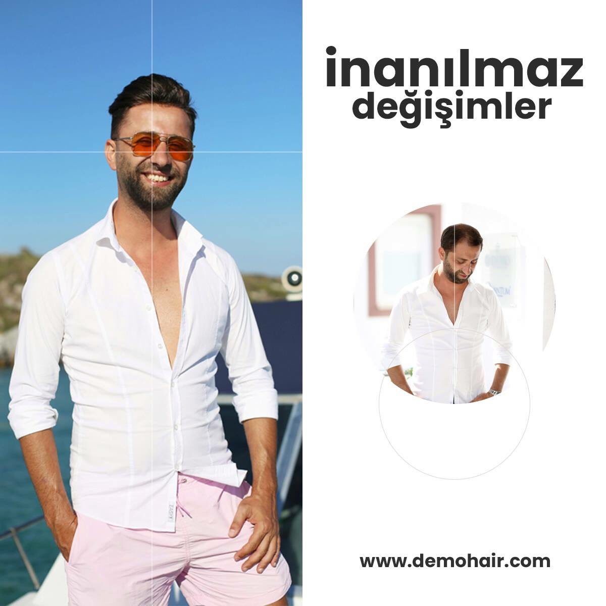 demohair's tweet image. #DemoHair güvencesi ve #QuantumSystem kalitesi... Bodrum Sebastian Beach ve Club işletmecisi Soner Ayhan&apos;ın da tercihi Demo Hair ile Quantum System oldu!