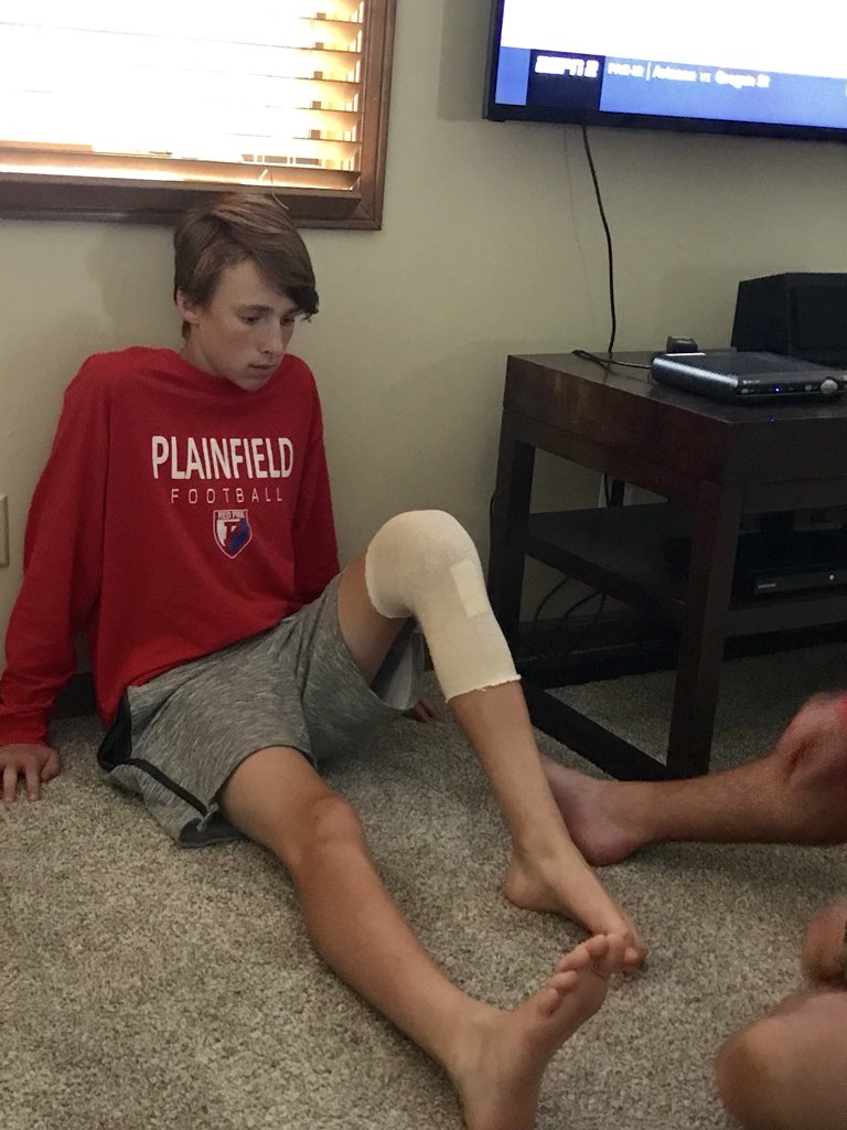 shelley_moyers's tweet image. 5 days post ACL/meniscus surgery-putting in the work!  Arik and @CoachMoyers Saturday rehab! #workinghard #readyforthechallenge