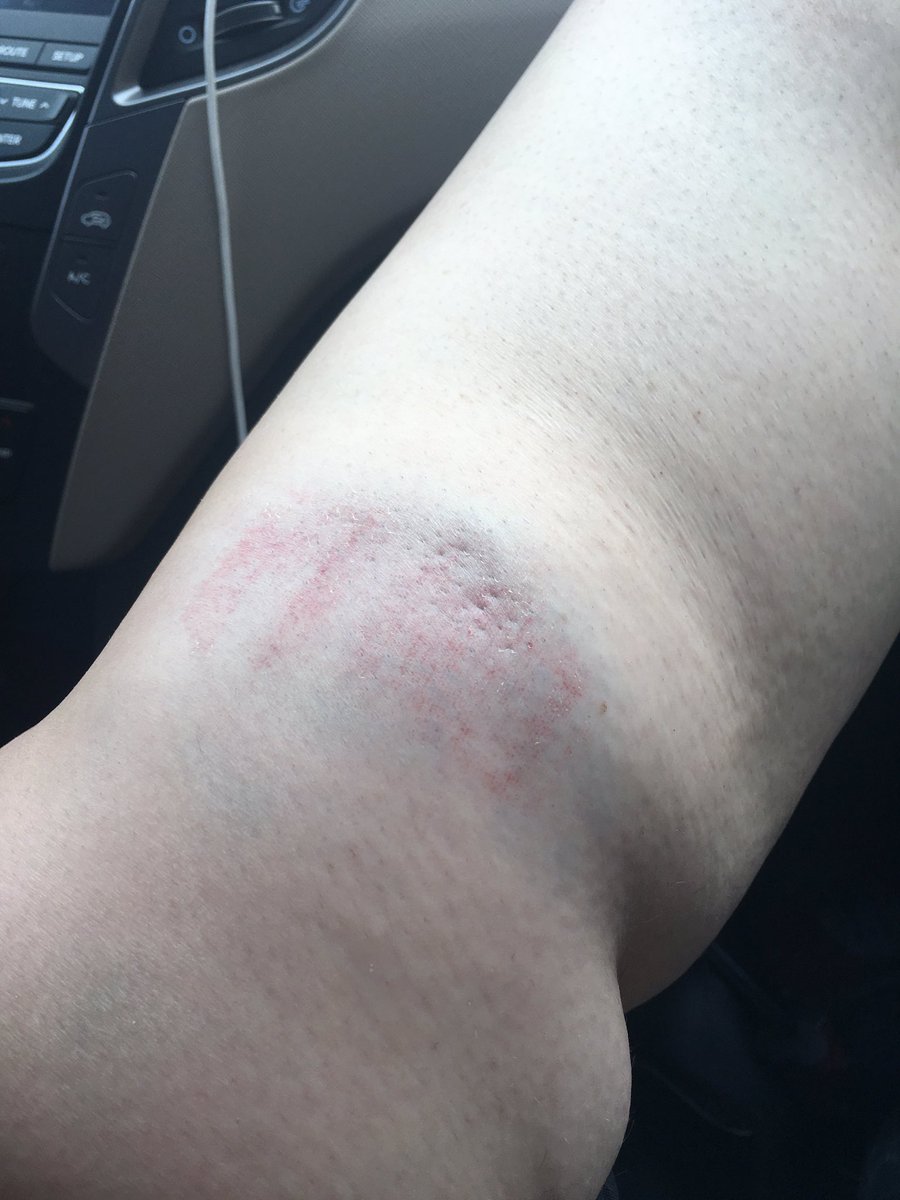 psdrmiller's tweet photo. #spartancbp finished my first spartan run in just over an hour. So rewarding to push yourself to reach new goals. I hope this inspires my students to do the same. Only one bump to show for it. #goals #growthmindset https://t.co/gzGbEdedUK
