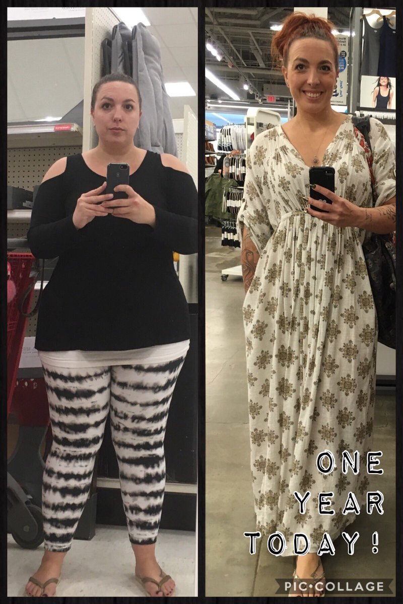 One year and 90 lbs later. My #etlwalk is faster than ever. @NYBariatric #commitment #BariatricSurgery #sleevelife