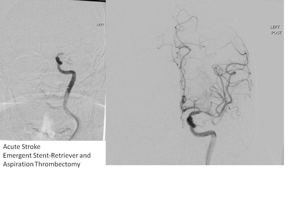 AzeneMD's tweet image. IR’s do everything. Provide tremendous value to their practices, hospitals, and healthcare. No other procedural specialty can provide the same depth and breadth as IR. This is only half of the procedures performed by 1 IR in 1 day on 9/20; and it’s routine. @SIRspecialists #IRad