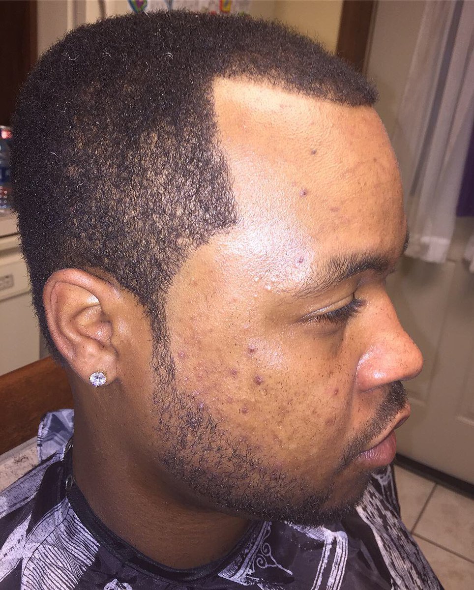 CutzTaylor's tweet photo. Justin stopped by for a shape up today. Thanks for choosing #taylordcutz #barber #barberlife #taperedcut #beardgang #newyorkbarber #hairstyles #fade #corning #upstateny #lineups #edgeups #barbershop #haircut #beardstyle #beards #newyork https://t.co/7Phca2AVWT