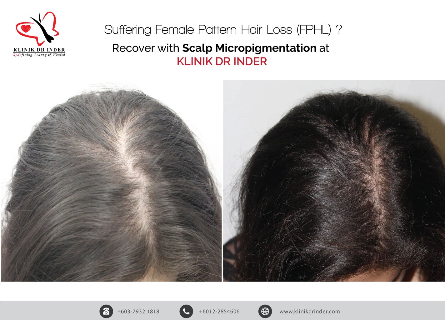 Klinik Dr. Inder on Twitter: Klinik Dr. Inder on Twitter: