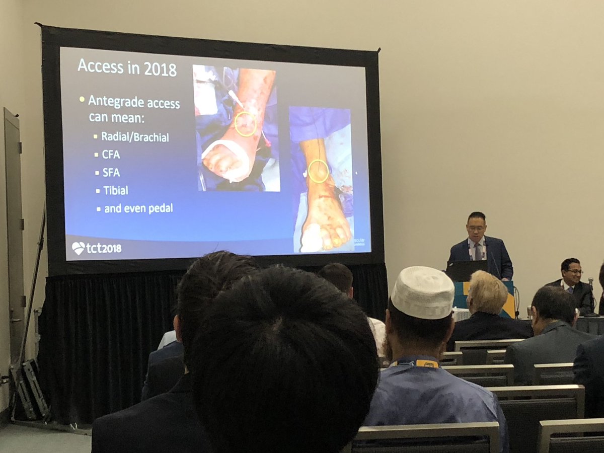 heartdoc45's tweet photo. Arthur Lee presenting PAD intervention access options. Sky’s the limit! #TCT2018 #PADRadialFirst #RadialFirst https://t.co/wradMgXj27