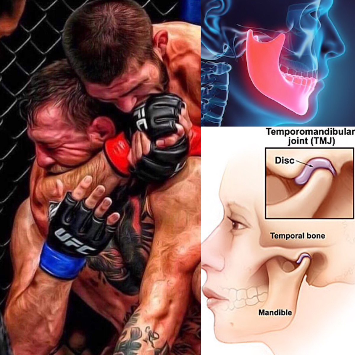 medjitsu's tweet photo. Khabib used a Jaw crank !  How Khabibs Jaw crank works vs how the REar naked choke works click link : https://t.co/ApL0v7fy47. Congratulations @TeamKhabib #KhabibNurmagomedov #KHABIBvsMcGregor #ufc299 #jaw #submissions #sambo #bjj #MMA #khabibvsconnor https://t.co/NfCj9TDm3D