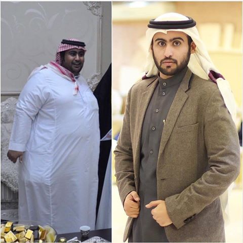 f_almoterq's tweet photo. الان لكم المنتج الفعال 😍😍
منتج ازالة الكرش 😍😍
تنظيف الجسم من السموم و الدهون وانقاص الوزن من 7 ل 12 كيلو في 21 ايام
آمن وطبيعي 
ترخيص صحي وتجاري 
🔺المكونات// طبيعية جدا ومرخصة 

للطلب والاستفسار التواصل عبر الواتس اب في التعليق

#اشياء_ماتكررِ
#شارك_بتصويرك_الجميلِ https://t.co/JYRcjHpYWx