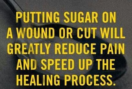 HealthOxygen's tweet photo. Putting #sugar on a wound or cut will greatly reduce pain and speed up the #healing process. https://t.co/fH2z94Ue1B